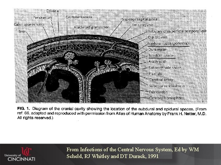 From Infections of the Central Nervous System, Ed by WM Scheld, RJ Whitley and