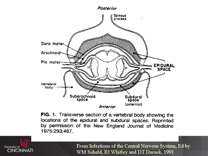 From Infections of the Central Nervous System, Ed by WM Scheld, RJ Whitley and