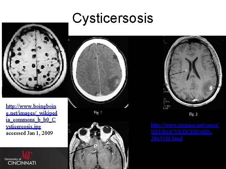 Cysticersosis http: //www. boingboin g. net/images/_wikiped ia_commons_b_b 0_C ysticercosis. jpg accessed Jan 1, 2009