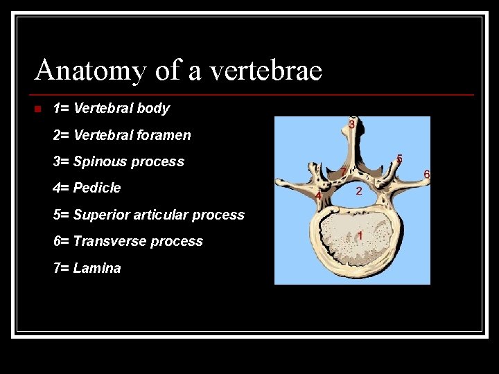 Anatomy of a vertebrae n 1= Vertebral body 2= Vertebral foramen 3= Spinous process