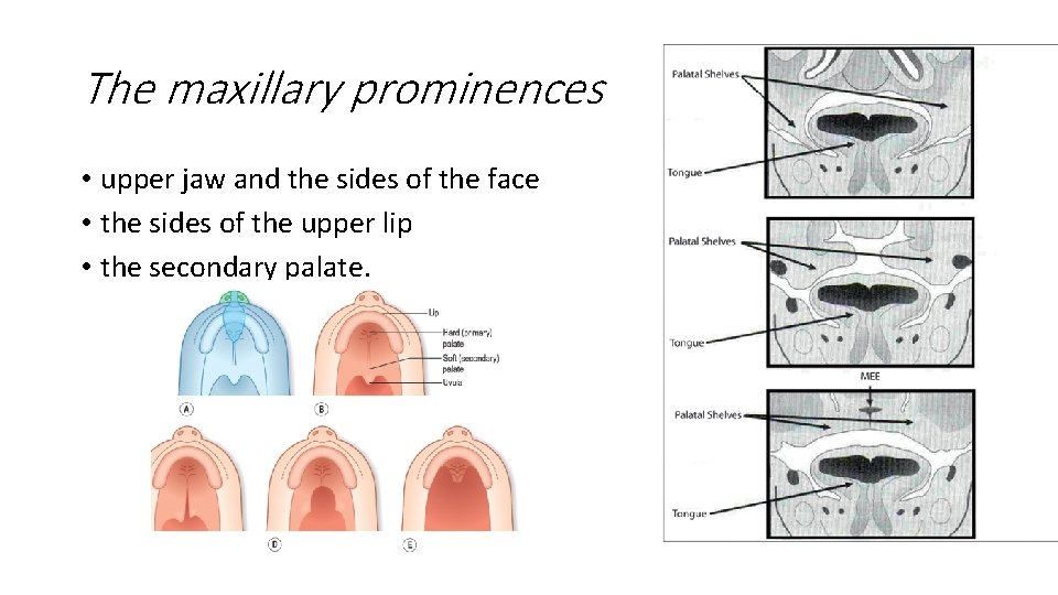 The maxillary prominences • upper jaw and the sides of the face • the