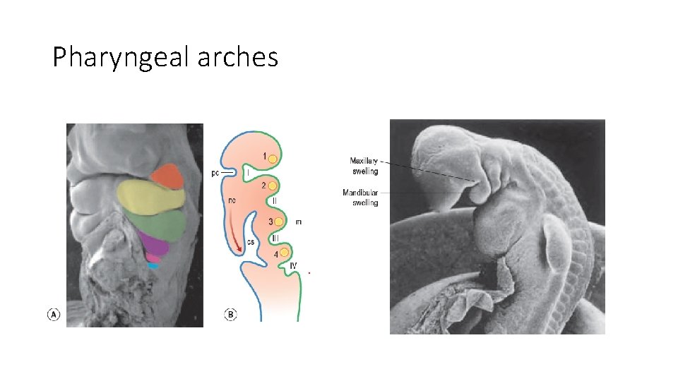 Pharyngeal arches 