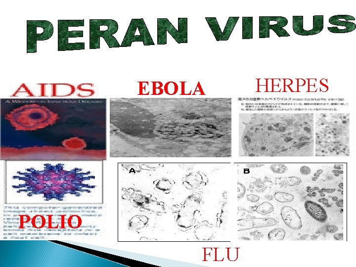 EBOLA POLIO FLU HERPES 