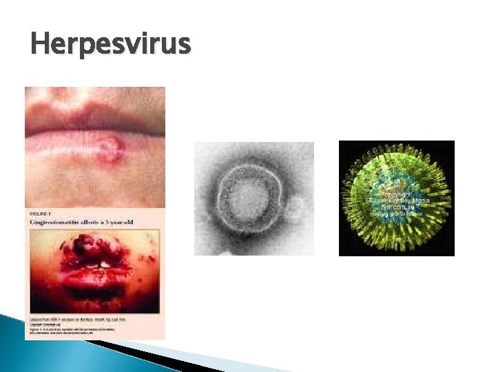 Herpesvirus 