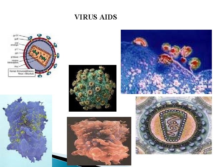 VIRUS AIDS 