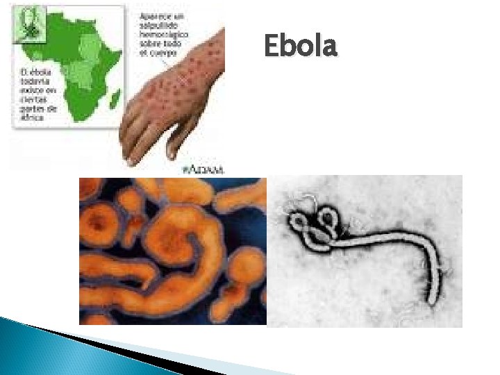 Ebola 