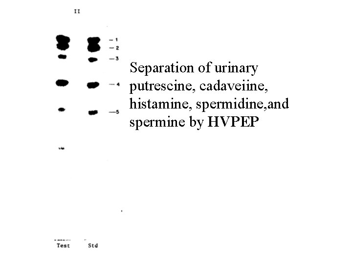 Separation of urinary putrescine, cadaveiine, histamine, spermidine, and spermine by HVPEP 
