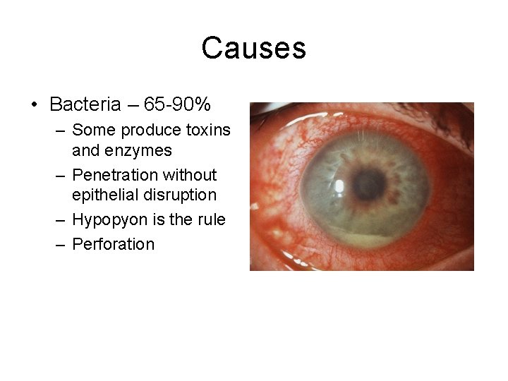 Causes • Bacteria – 65 -90% – Some produce toxins and enzymes – Penetration Causes • Bacteria – 65 -90% – Some produce toxins and enzymes – Penetration