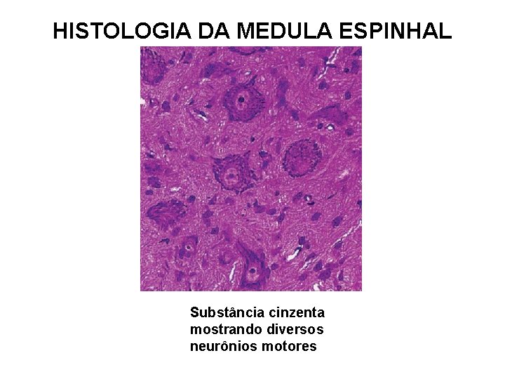 HISTOLOGIA DA MEDULA ESPINHAL Substância cinzenta mostrando diversos neurônios motores 