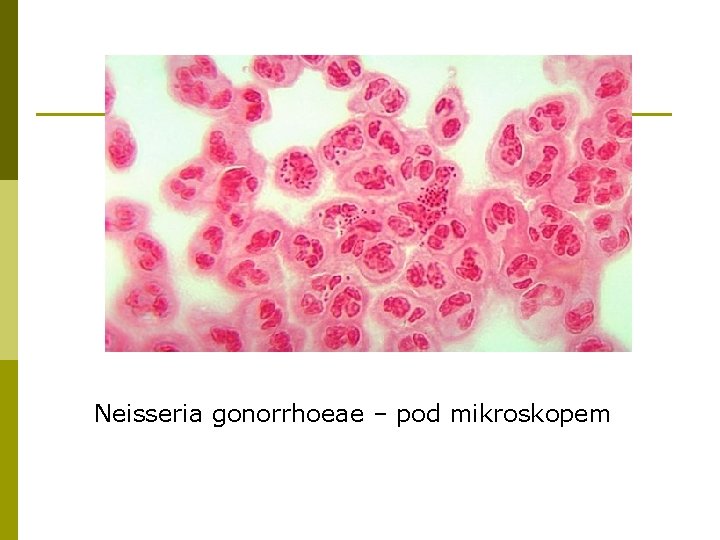  Neisseria gonorrhoeae – pod mikroskopem 