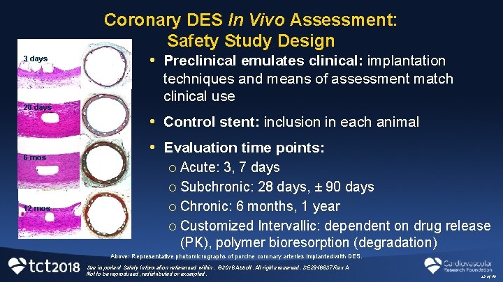 Coronary DES In Vivo Assessment: Safety Study Design 3 days 28 days 6 mos