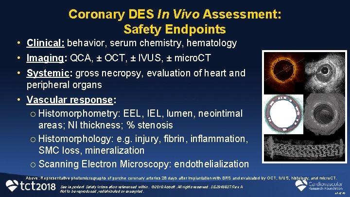Coronary DES In Vivo Assessment: Safety Endpoints • Clinical: behavior, serum chemistry, hematology •
