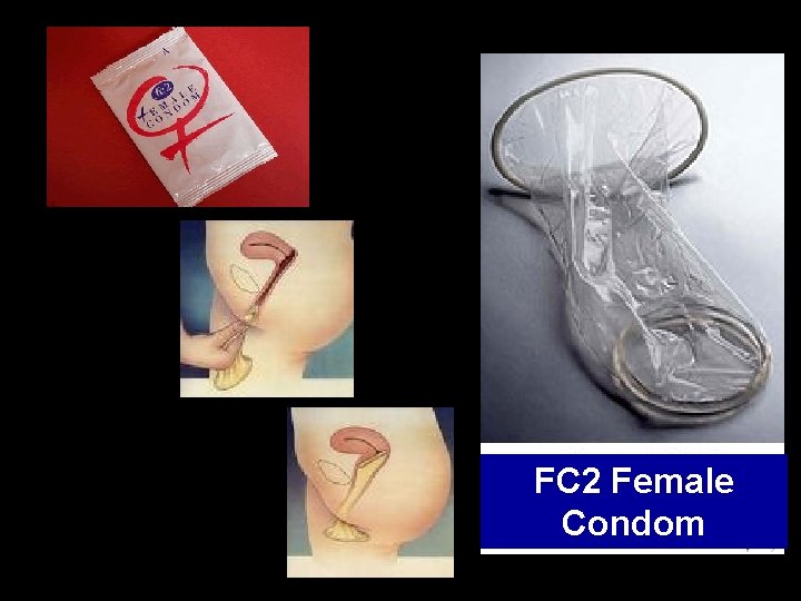 FC 2 Female Condom 