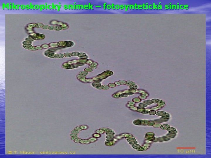 Mikroskopický snímek – fotosyntetická sinice 