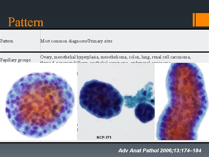 is spindle cell sarcoma hereditary