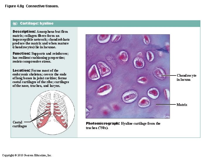 Figure 4. 8 g Connective tissues. (g) Cartilage: hyaline Description: Amorphous but firm matrix;