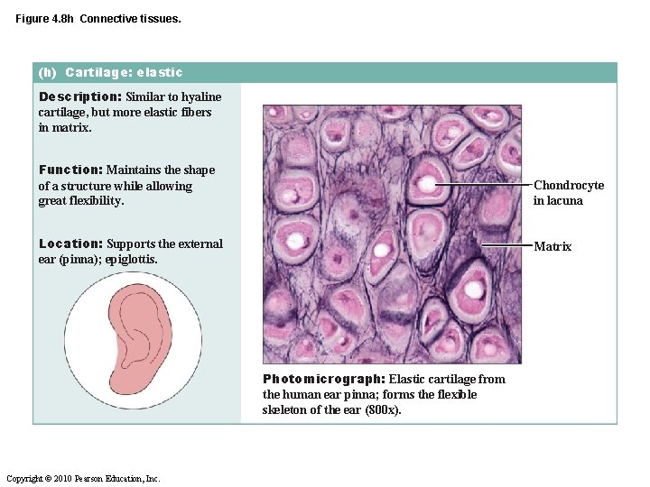 Figure 4. 8 h Connective tissues. (h) Cartilage: elastic Description: Similar to hyaline cartilage,