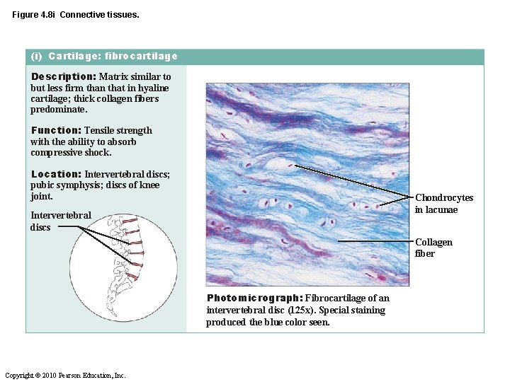 Figure 4. 8 i Connective tissues. (i) Cartilage: fibrocartilage Description: Matrix similar to but