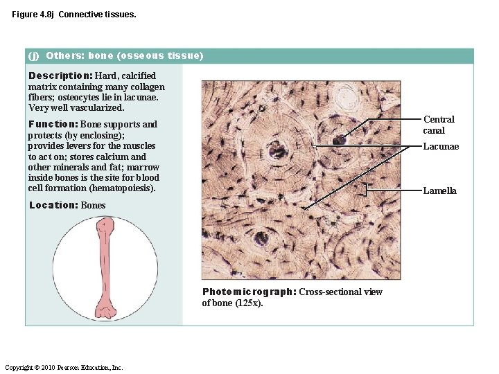 Figure 4. 8 j Connective tissues. (j) Others: bone (osseous tissue) Description: Hard, calcified