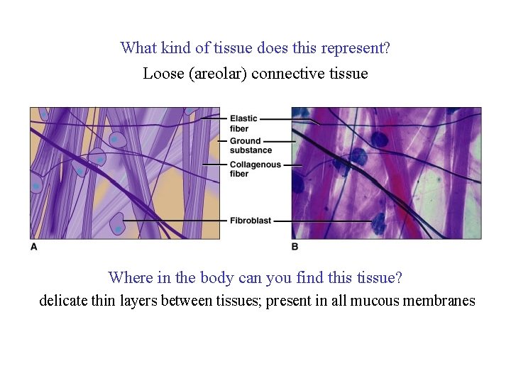 What kind of tissue does this represent? Loose (areolar) connective tissue Where in the