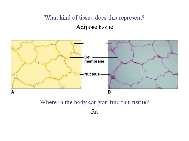 What kind of tissue does this represent? Adipose tissue Where in the body can