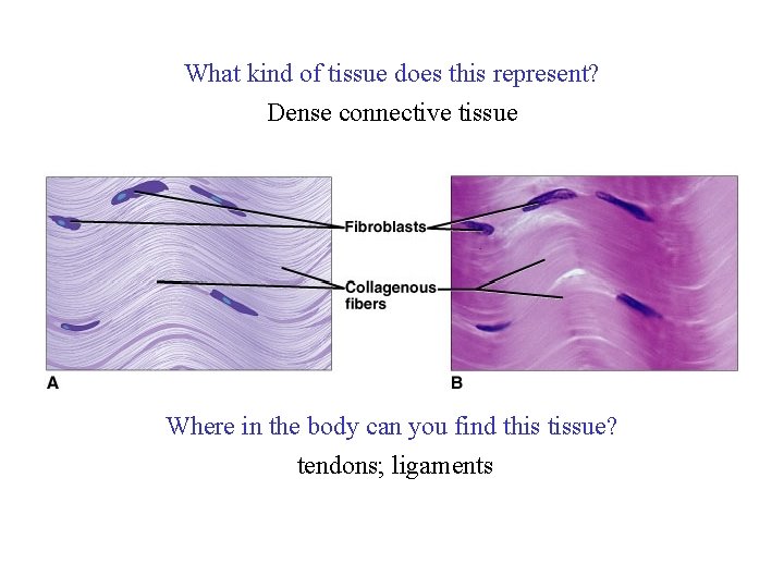 What kind of tissue does this represent? Dense connective tissue Where in the body