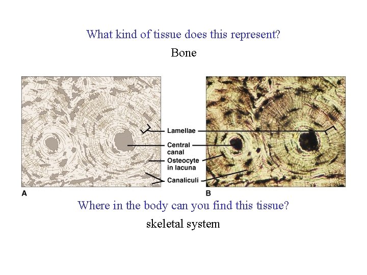 What kind of tissue does this represent? Bone Where in the body can you