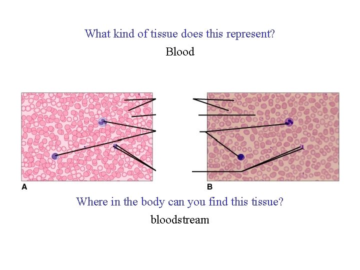 What kind of tissue does this represent? Blood Where in the body can you