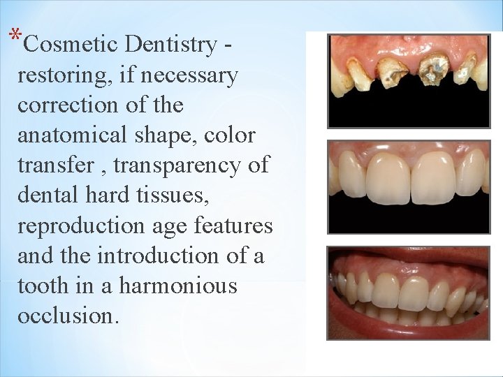 *Cosmetic Dentistry restoring, if necessary correction of the anatomical shape, color transfer , transparency