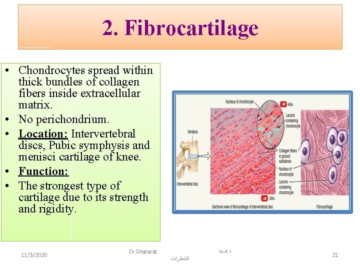 2. Fibrocartilage • Chondrocytes spread within thick bundles of collagen fibers inside extracellular matrix.