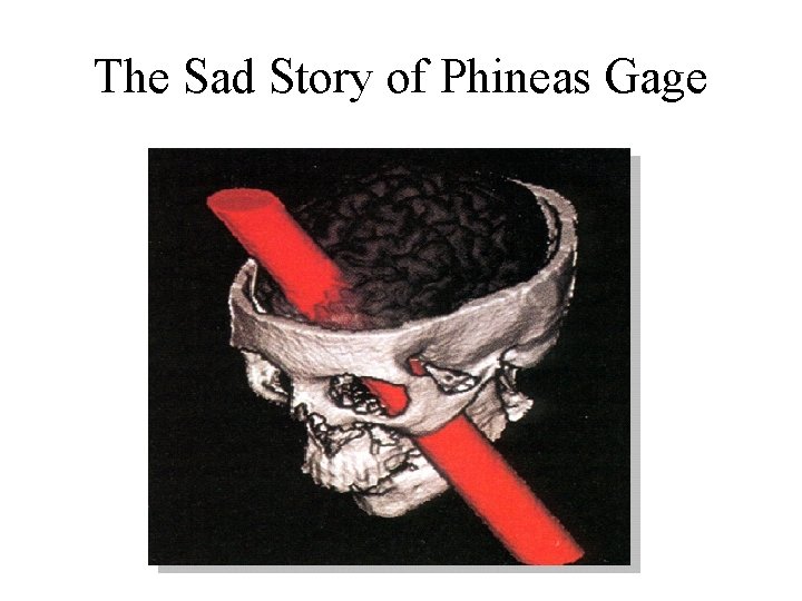 The Sad Story of Phineas Gage 