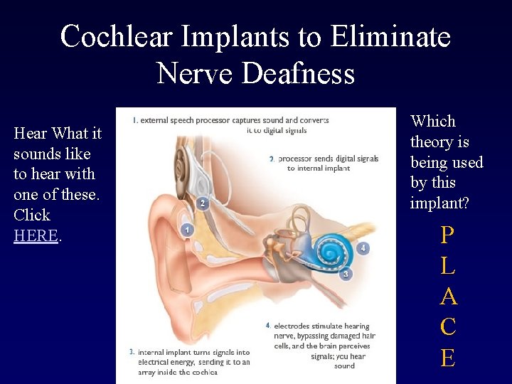 Cochlear Implants to Eliminate Nerve Deafness Hear What it sounds like to hear with