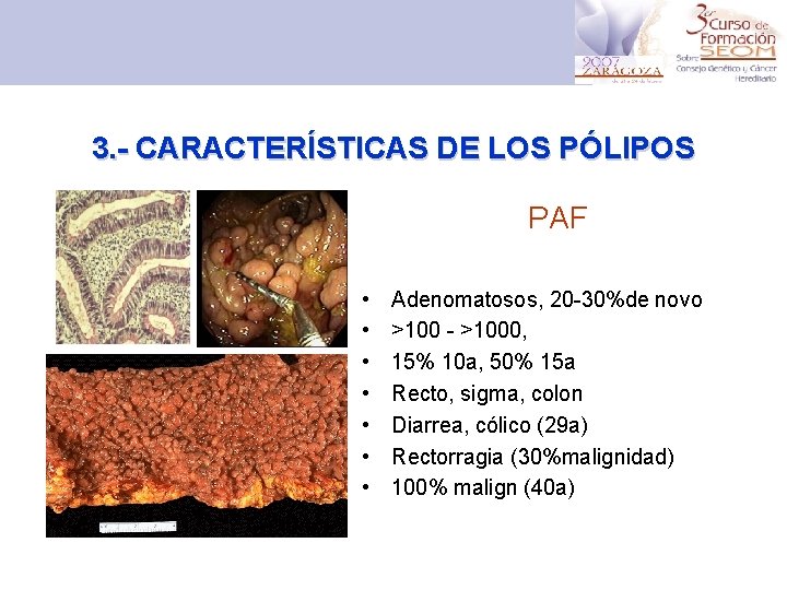 3. - CARACTERÍSTICAS DE LOS PÓLIPOS PAF • • Adenomatosos, 20 -30%de novo >100