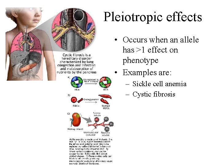 Pleiotropic effects • Occurs when an allele has >1 effect on phenotype • Examples