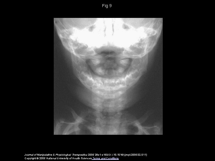 Fig 9 Journal of Manipulative & Physiological Therapeutics 2005 28 e 1 -e 15