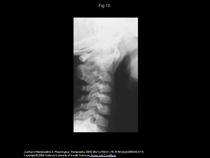 Fig 10 Journal of Manipulative & Physiological Therapeutics 2005 28 e 1 -e 15