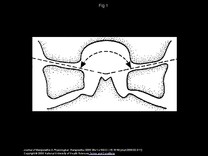 Fig 1 Journal of Manipulative & Physiological Therapeutics 2005 28 e 1 -e 15