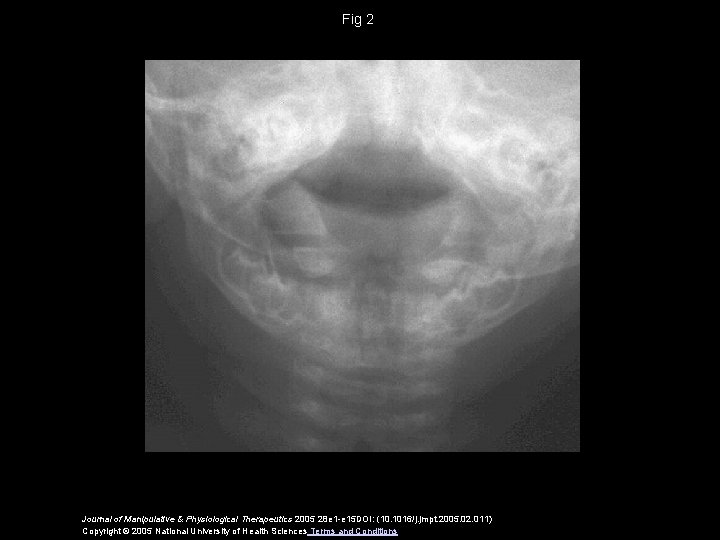 Fig 2 Journal of Manipulative & Physiological Therapeutics 2005 28 e 1 -e 15