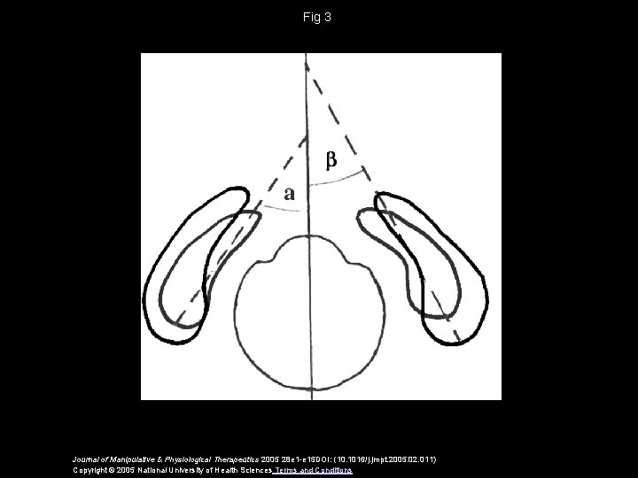 Fig 3 Journal of Manipulative & Physiological Therapeutics 2005 28 e 1 -e 15