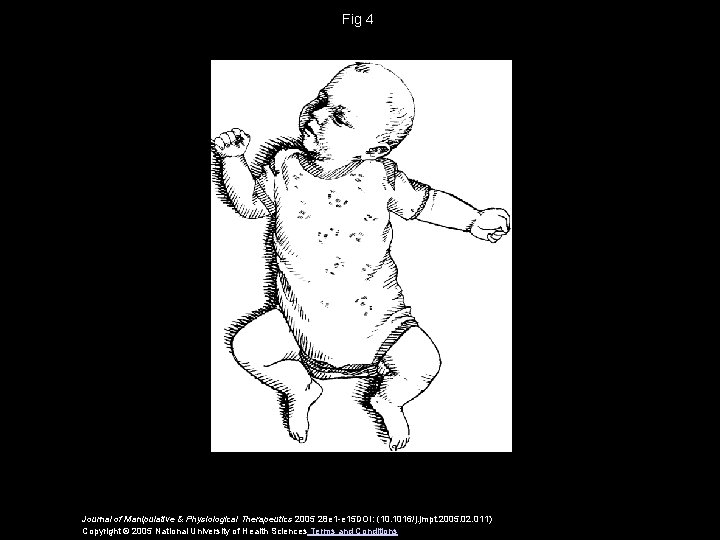 Fig 4 Journal of Manipulative & Physiological Therapeutics 2005 28 e 1 -e 15