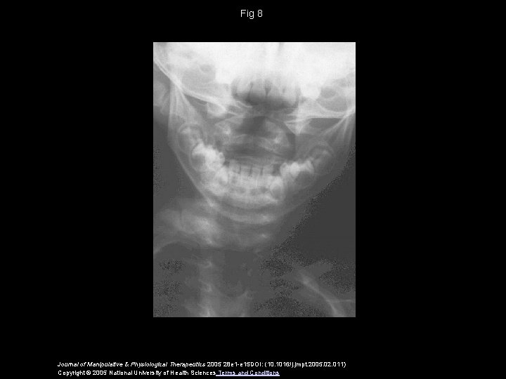 Fig 8 Journal of Manipulative & Physiological Therapeutics 2005 28 e 1 -e 15