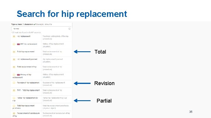 Search for hip replacement Total Revision Partial 35 
