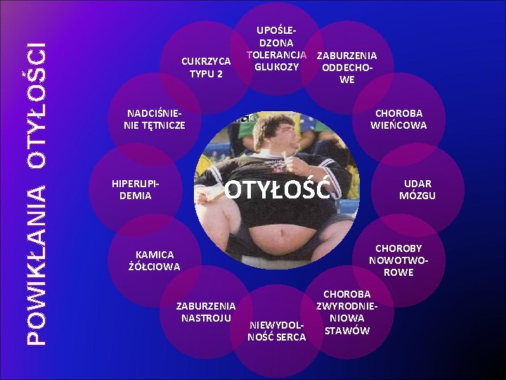 POWIKŁANIA OTYŁOŚCI CUKRZYCA TYPU 2 UPOŚLEDZONA TOLERANCJA ZABURZENIA GLUKOZY ODDECHOWE NADCIŚNIENIE TĘTNICZE CHOROBA WIEŃCOWA