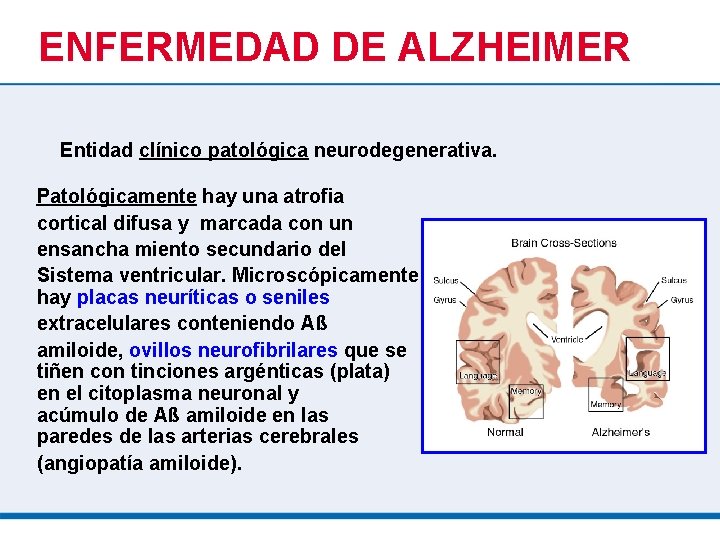 ENFERMEDAD DE ALZHEIMER Entidad clínico patológica neurodegenerativa. Patológicamente hay una atrofia cortical difusa y