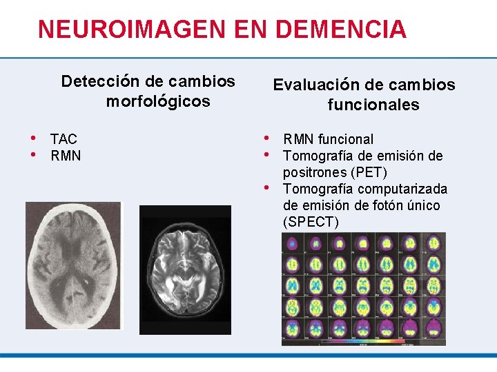 NEUROIMAGEN EN DEMENCIA Detección de cambios morfológicos • • Evaluación de cambios funcionales •