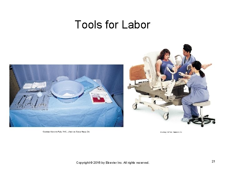 Tools for Labor Copyright © 2016 by Elsevier Inc. All rights reserved. 21 