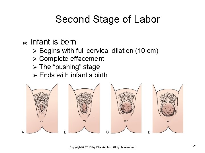Second Stage of Labor Infant is born Ø Ø Begins with full cervical dilation