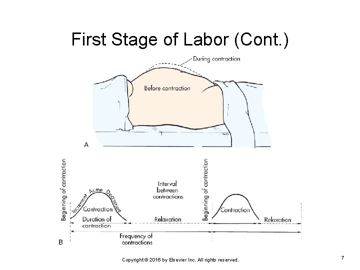 First Stage of Labor (Cont. ) Copyright © 2016 by Elsevier Inc. All rights