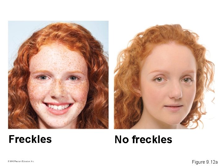 Freckles No freckles Figure 9. 12 a 