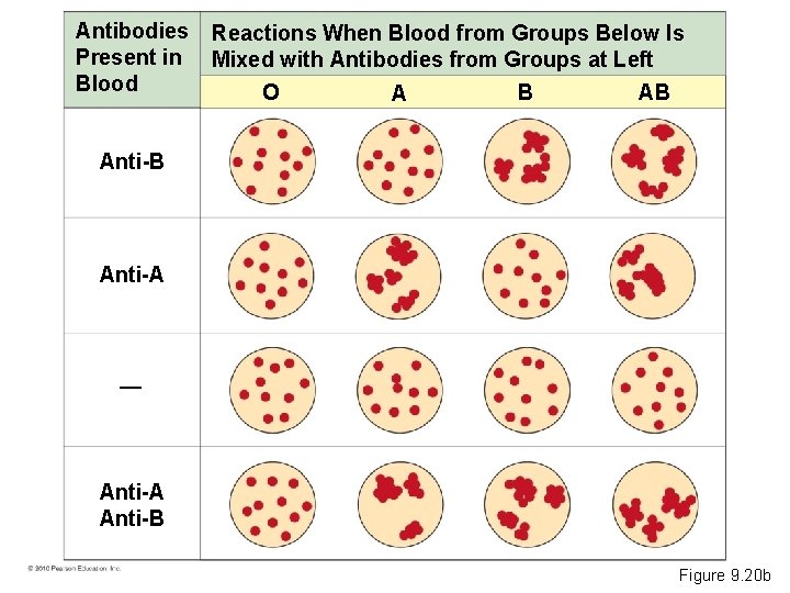 Antibodies Present in Blood Reactions When Blood from Groups Below Is Mixed with Antibodies